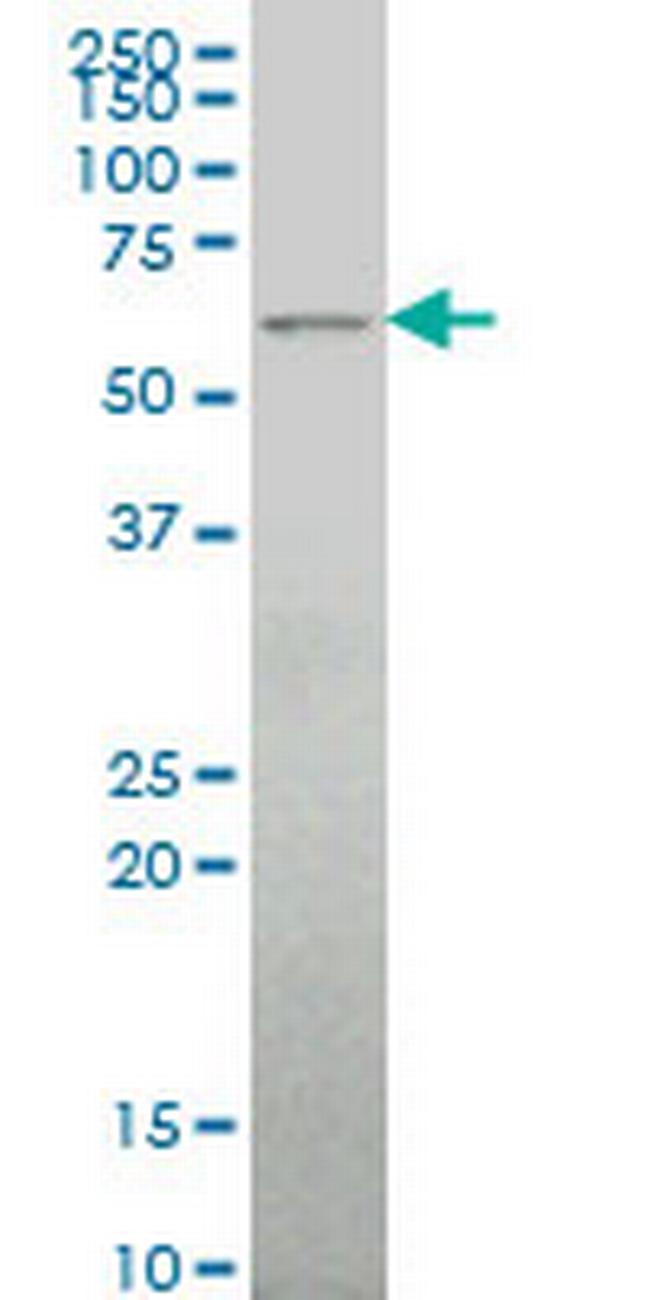 ALG6 Antibody in Western Blot (WB)