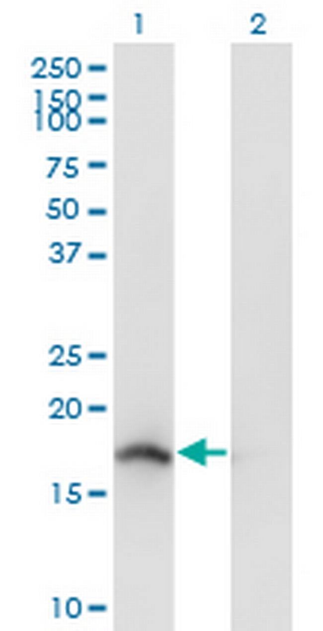 NENF Antibody in Western Blot (WB)