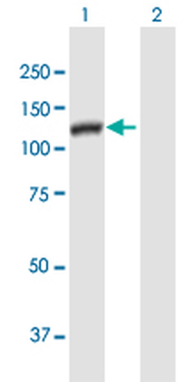 DSE Antibody in Western Blot (WB)