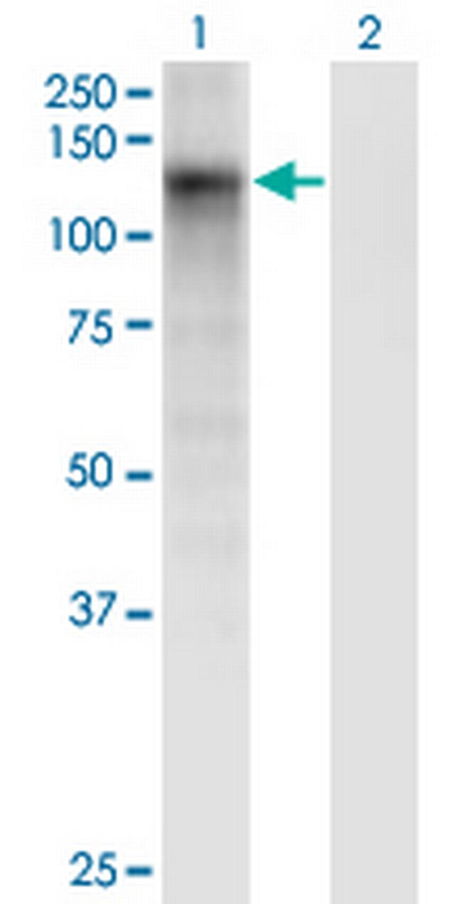 DSE Antibody in Western Blot (WB)