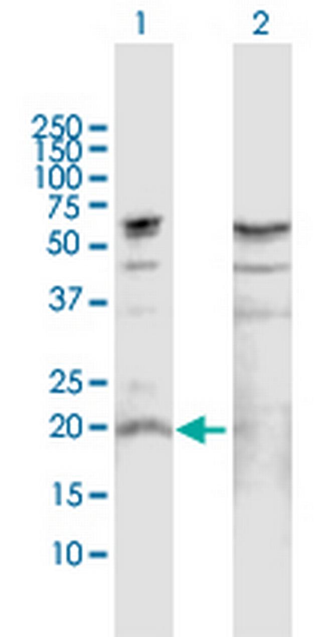 IL19 Antibody in Western Blot (WB)