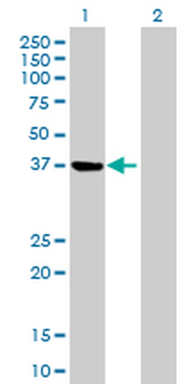 PSAT1 Antibody in Western Blot (WB)