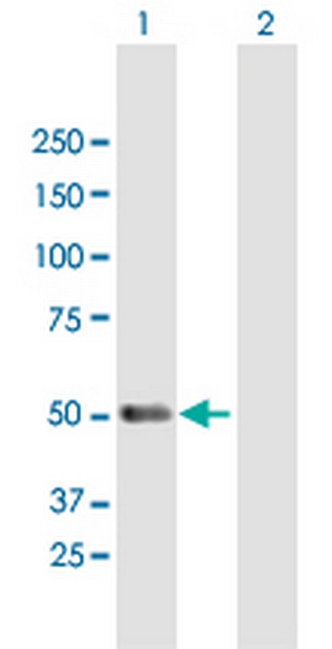 PACSIN1 Antibody in Western Blot (WB)