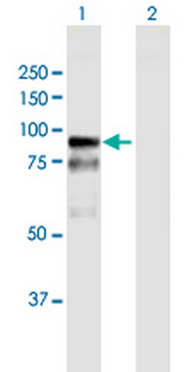 BAZ2B Antibody in Western Blot (WB)
