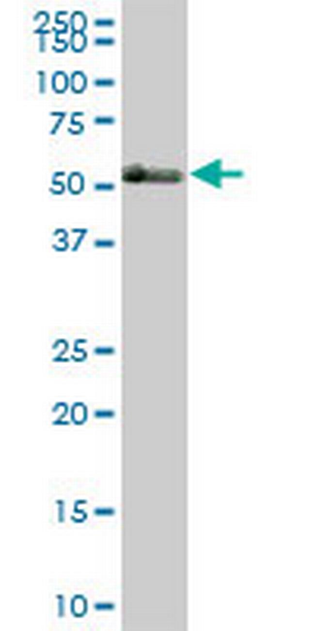 TBX21 Antibody in Western Blot (WB)