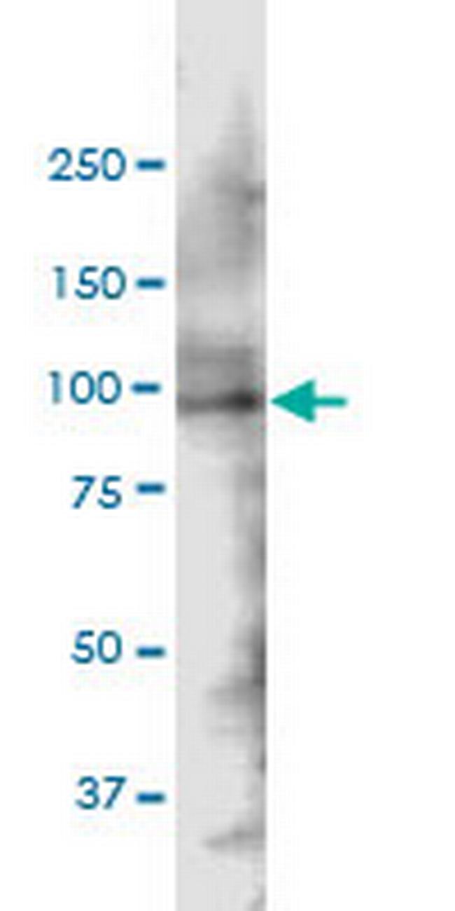 SH3KBP1 Antibody in Western Blot (WB)