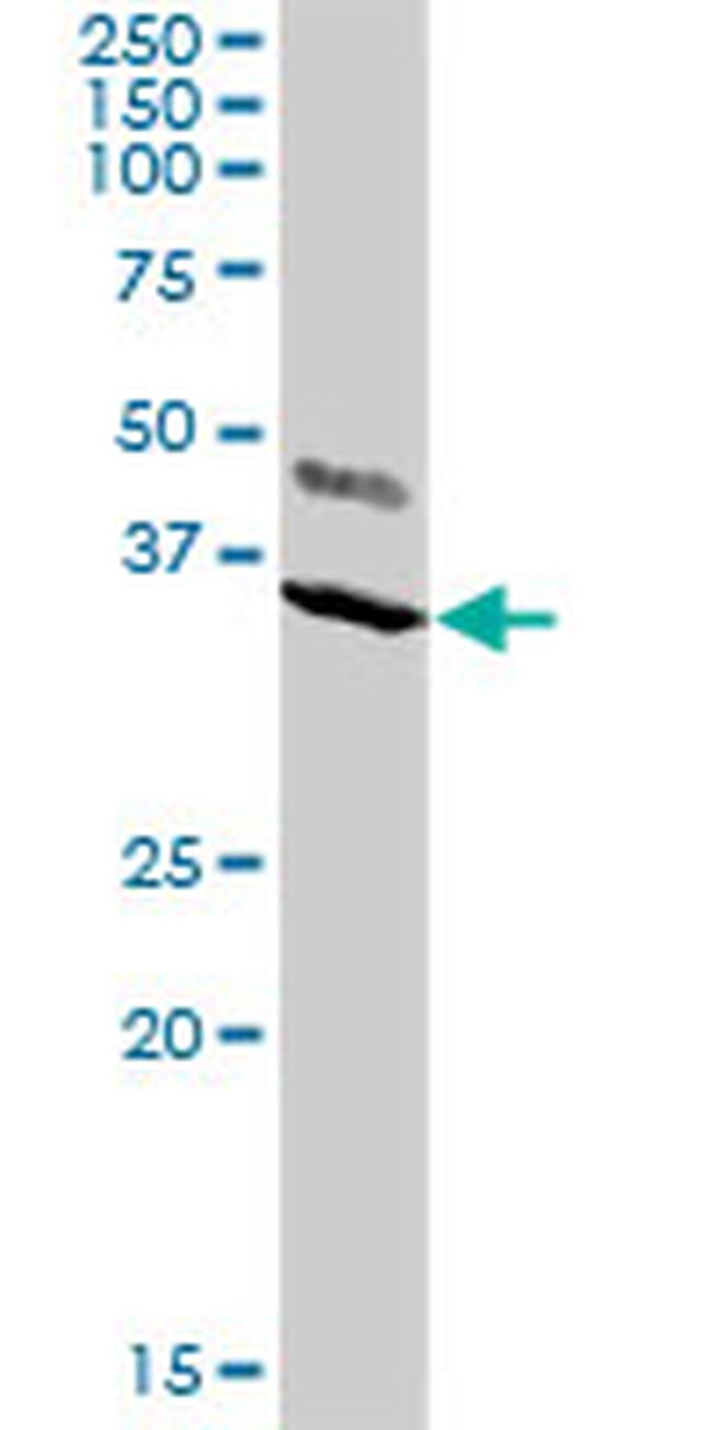 KCNIP2 Antibody in Western Blot (WB)