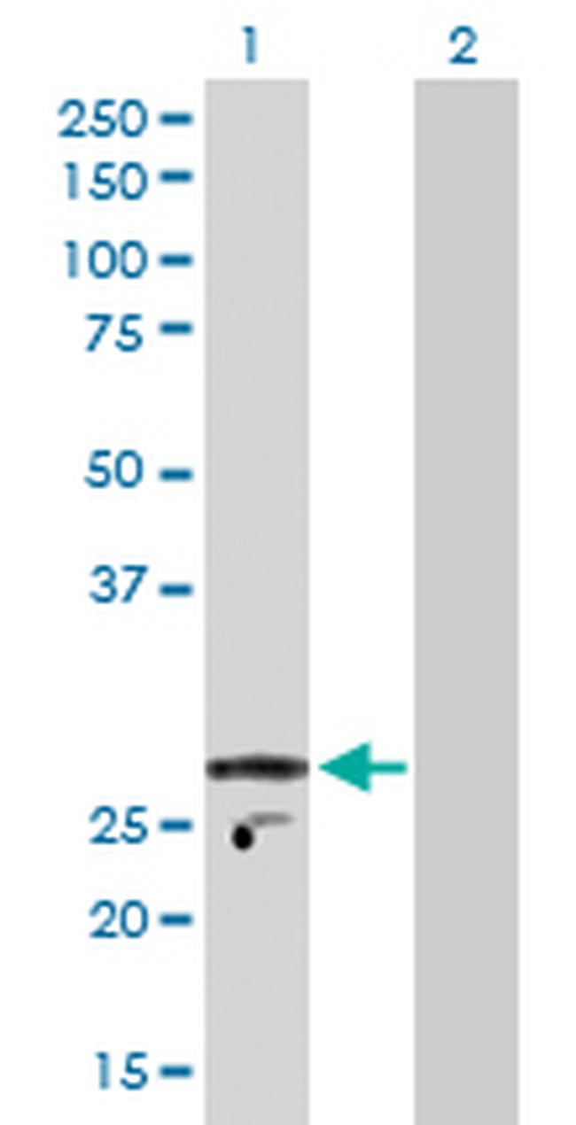 KCNIP2 Antibody in Western Blot (WB)