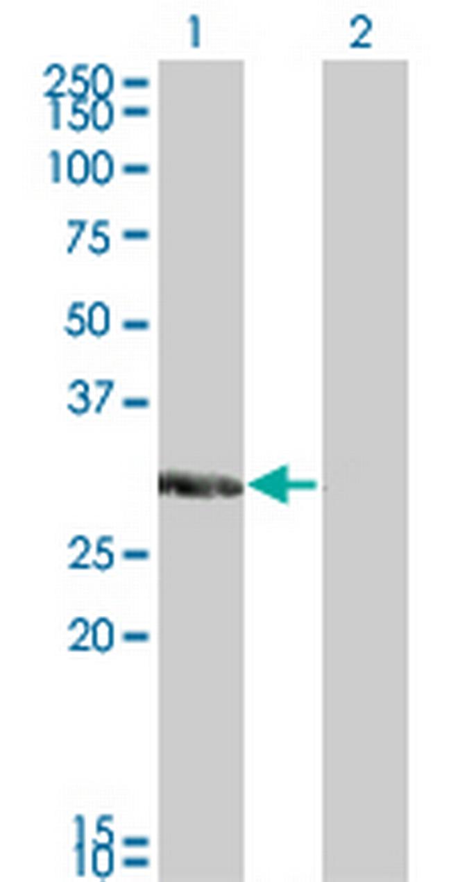 KCNIP2 Antibody in Western Blot (WB)