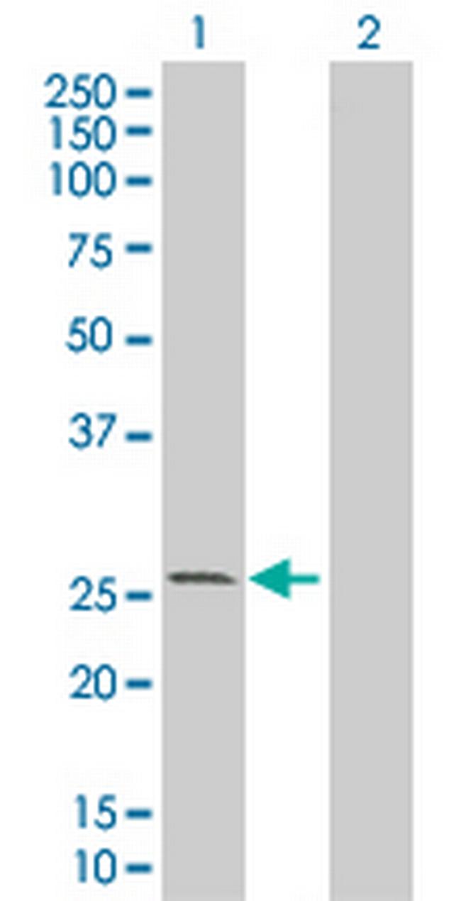 KCNIP1 Antibody in Western Blot (WB)