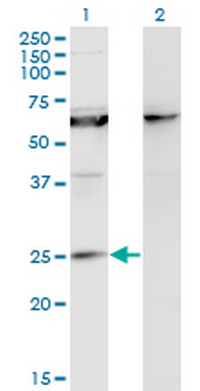 KCNIP1 Antibody in Western Blot (WB)