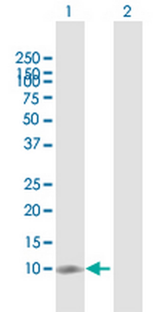 NT5C Antibody in Western Blot (WB)