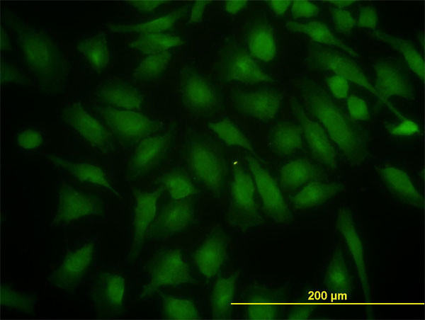 PIK3R4 Antibody in Immunocytochemistry (ICC/IF)