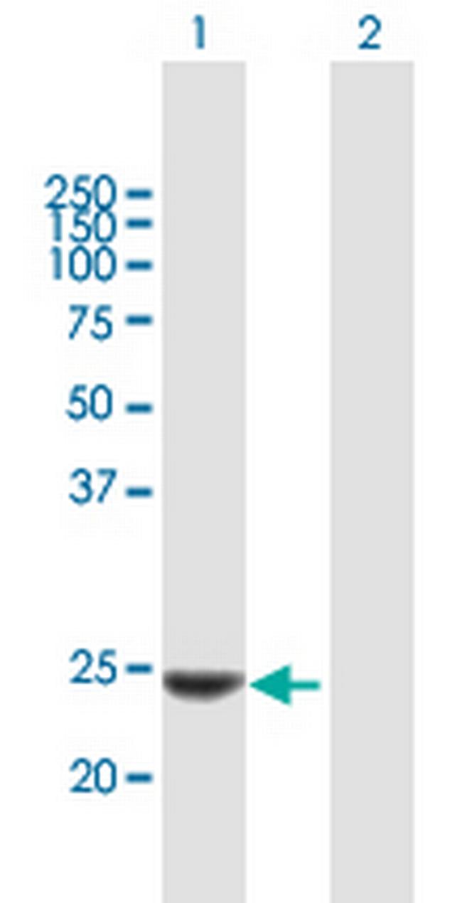 KLK14 Antibody in Western Blot (WB)