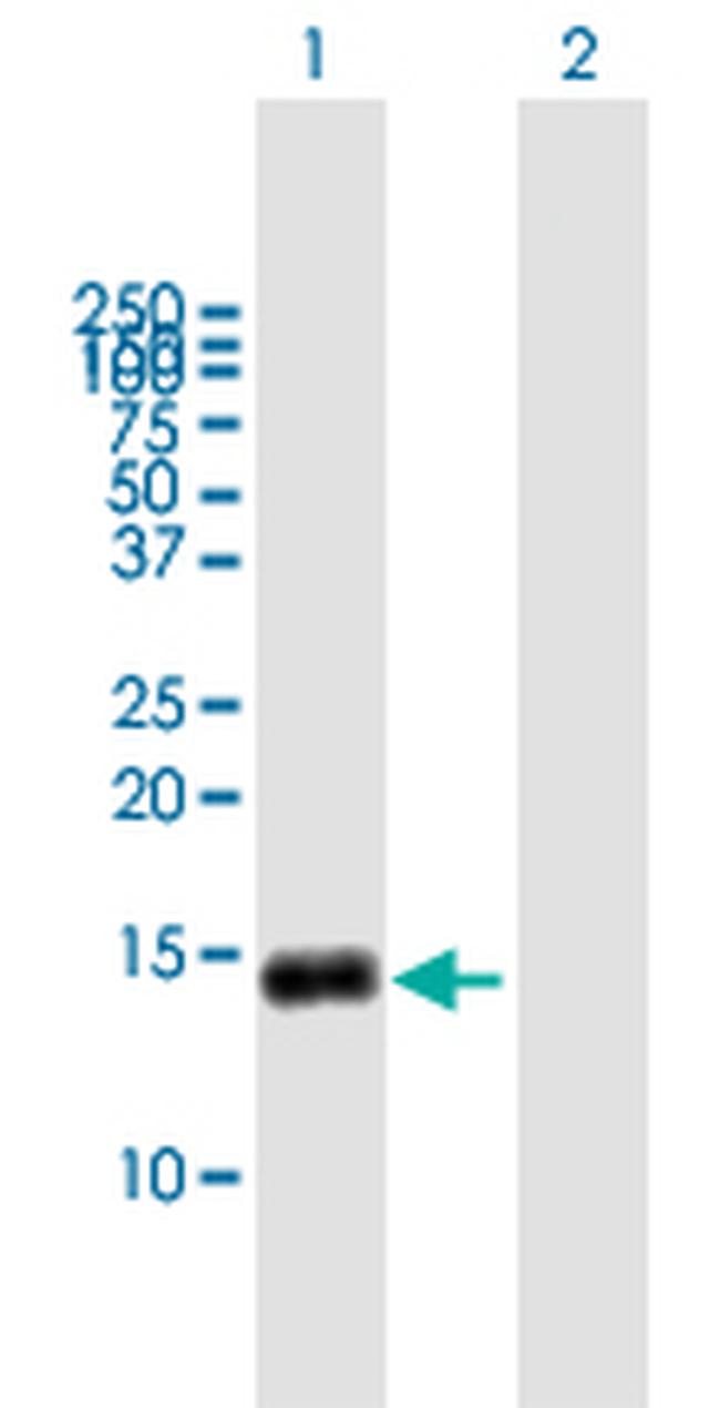 G0S2 Antibody in Western Blot (WB)