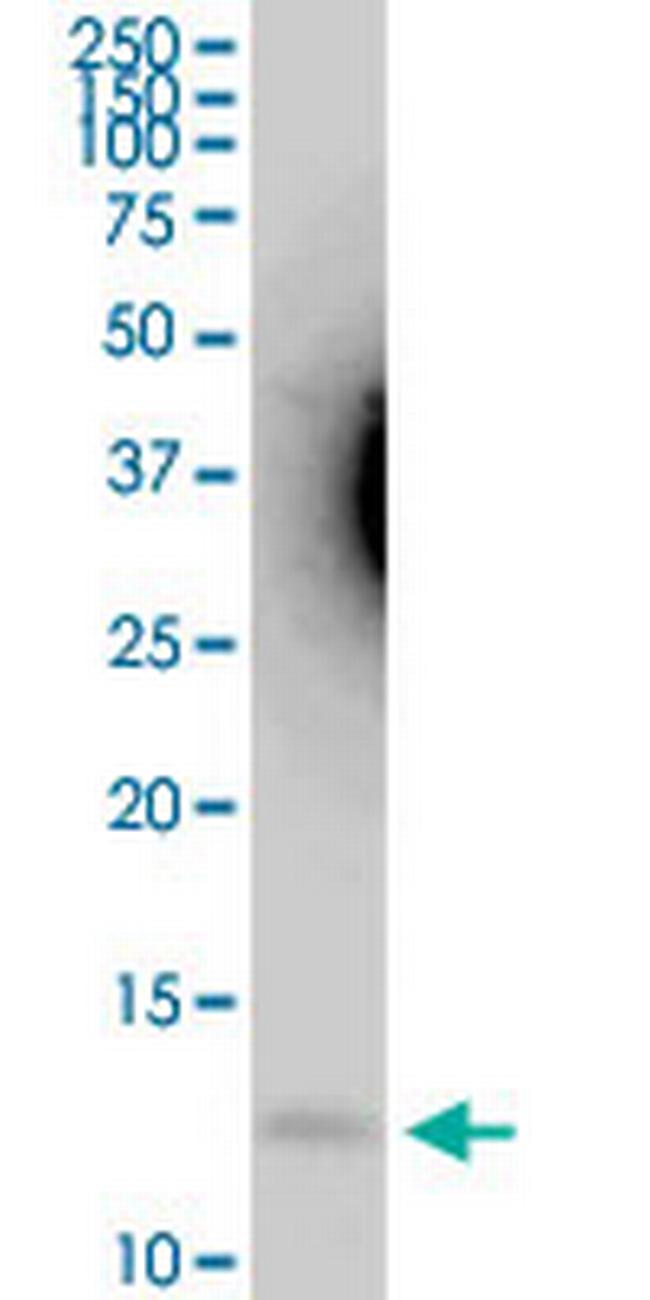 G0S2 Antibody in Western Blot (WB)