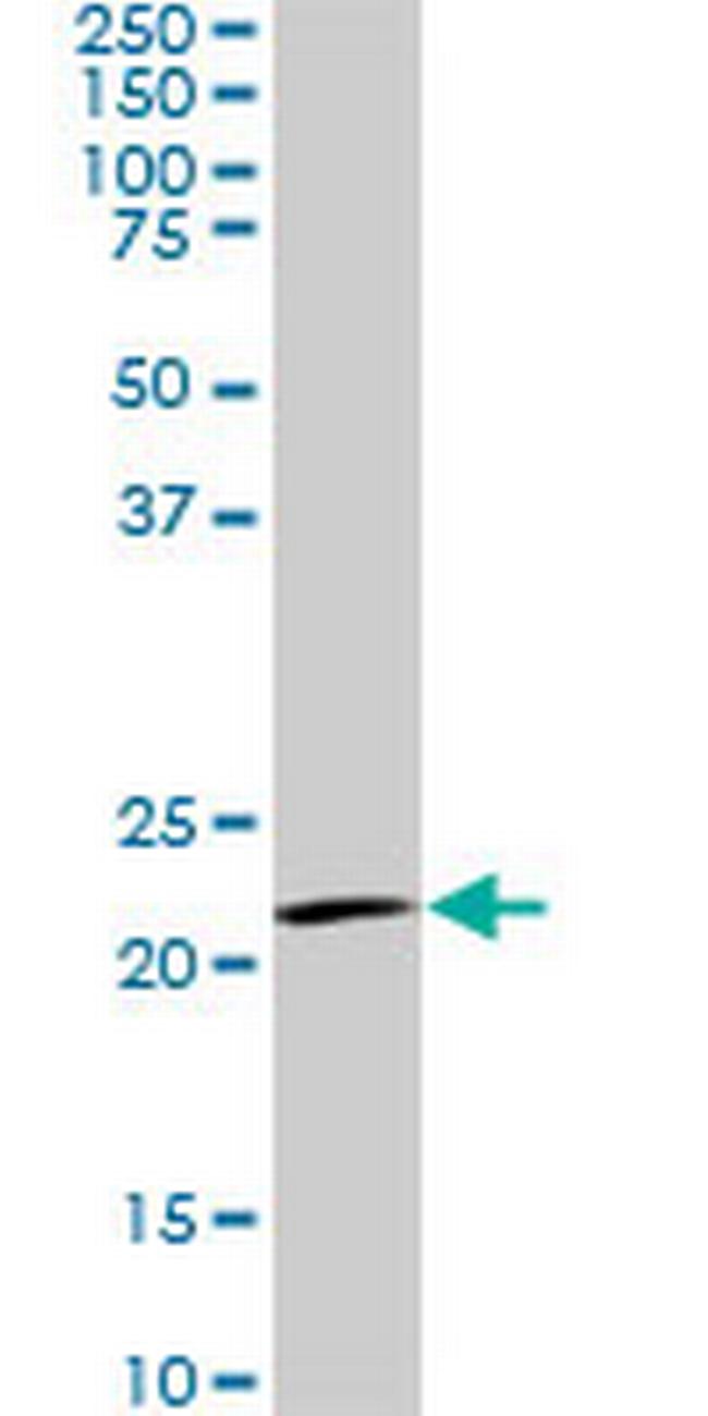 IL20 Antibody in Western Blot (WB)