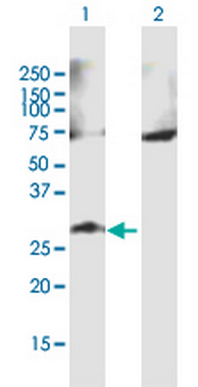 GALNT9 Antibody in Western Blot (WB)