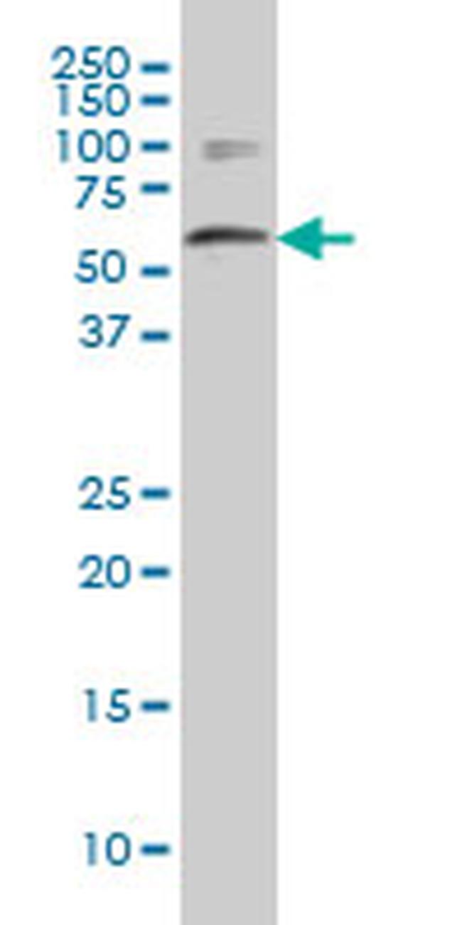 WDR42A Antibody in Western Blot (WB)