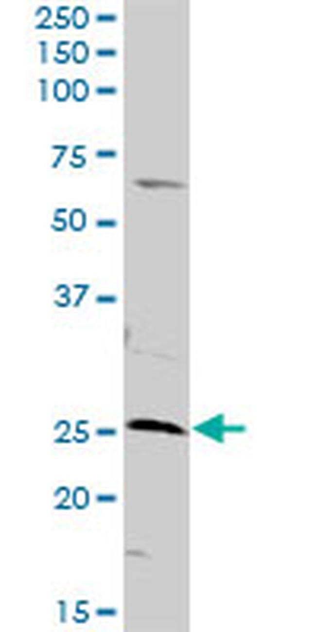 AK3 Antibody in Western Blot (WB)