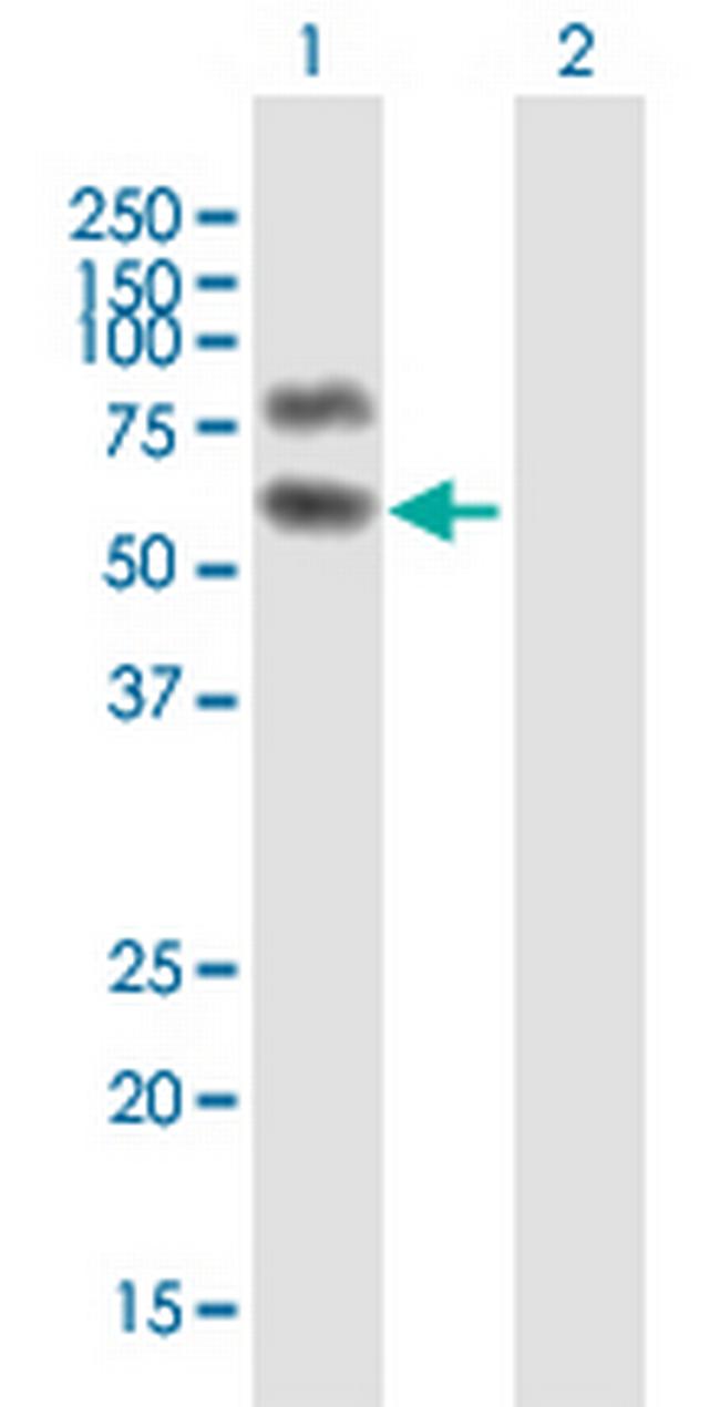 HP1BP3 Antibody in Western Blot (WB)