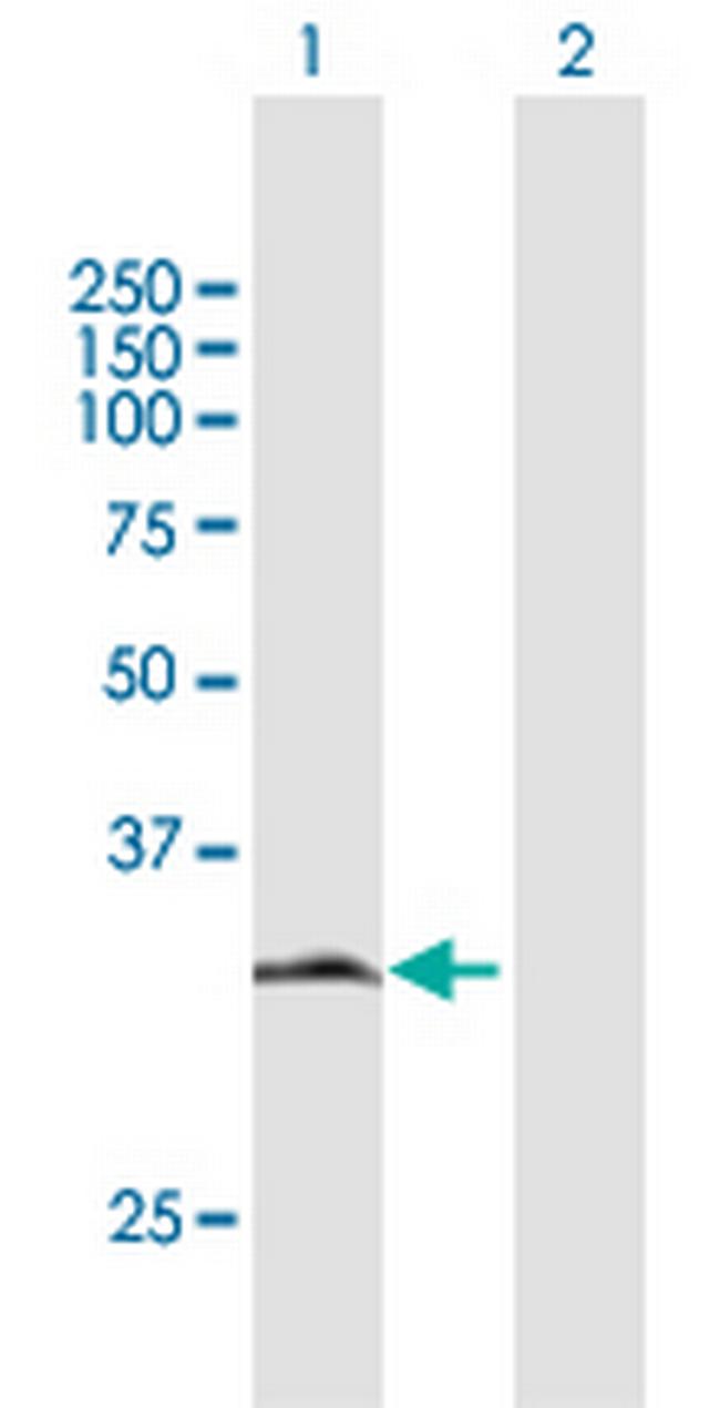 HDGFRP3 Antibody in Western Blot (WB)