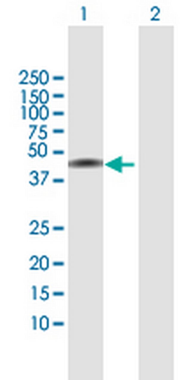 NSDHL Antibody in Western Blot (WB)