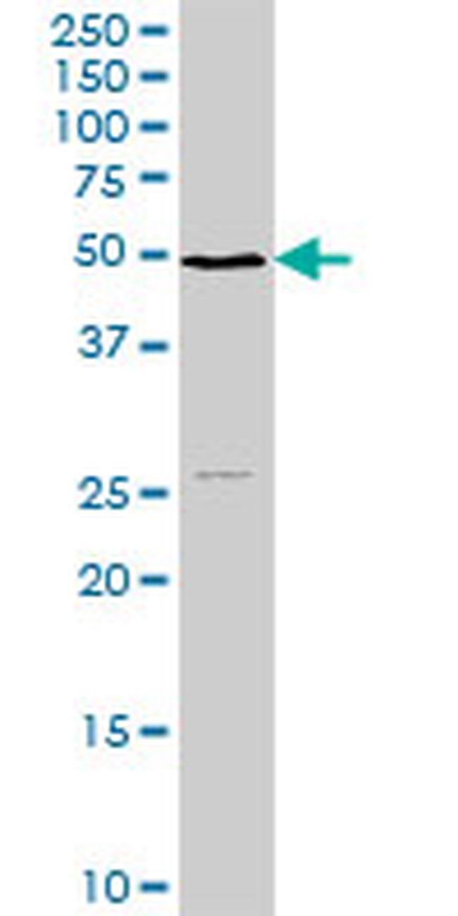 NSDHL Antibody in Western Blot (WB)