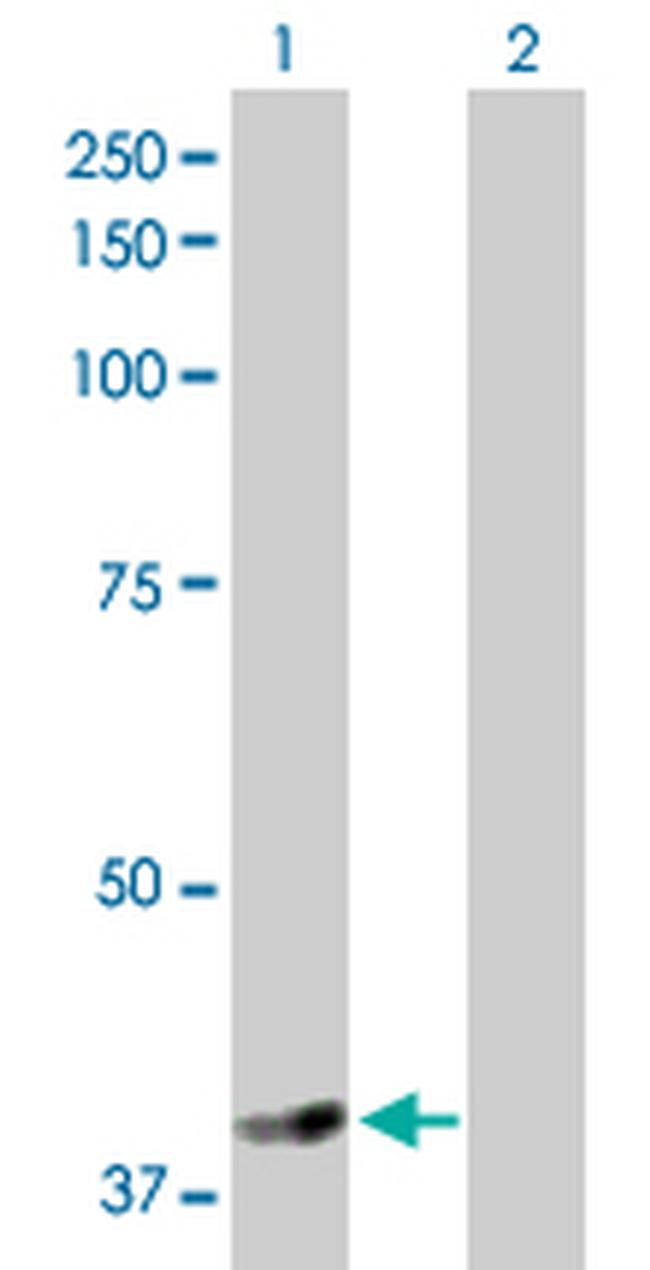 NSDHL Antibody in Western Blot (WB)