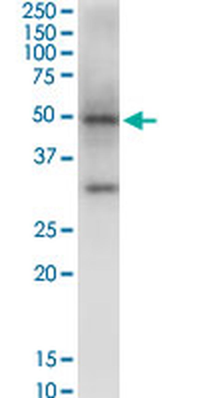 NSDHL Antibody in Western Blot (WB)