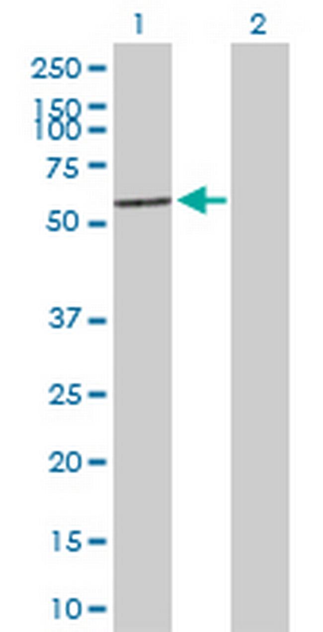 TBX22 Antibody in Western Blot (WB)