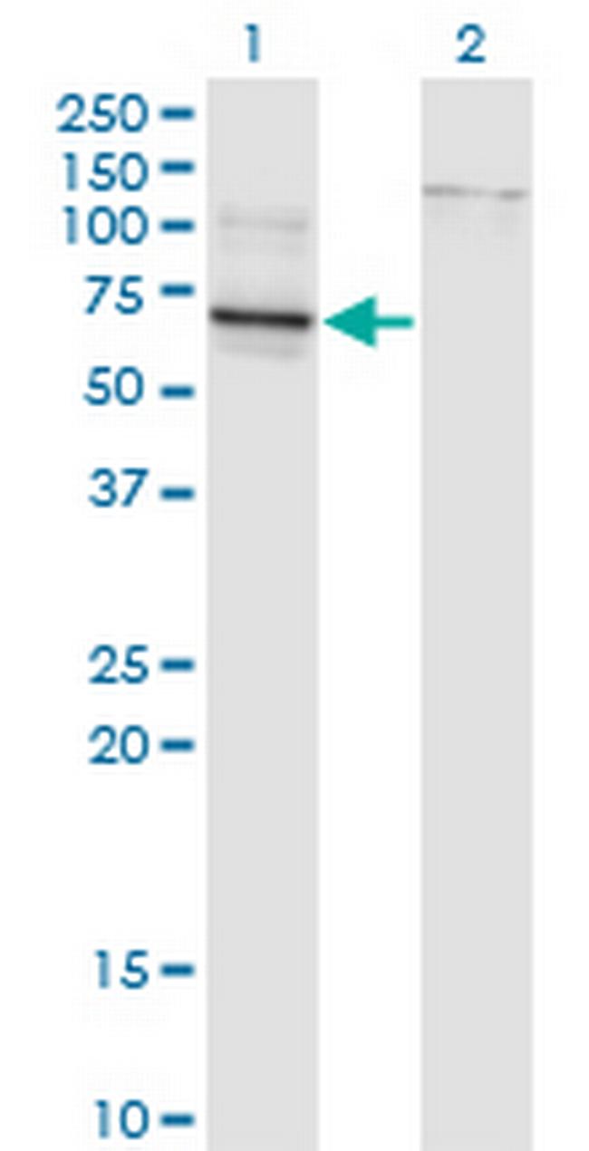 TBX22 Antibody in Western Blot (WB)