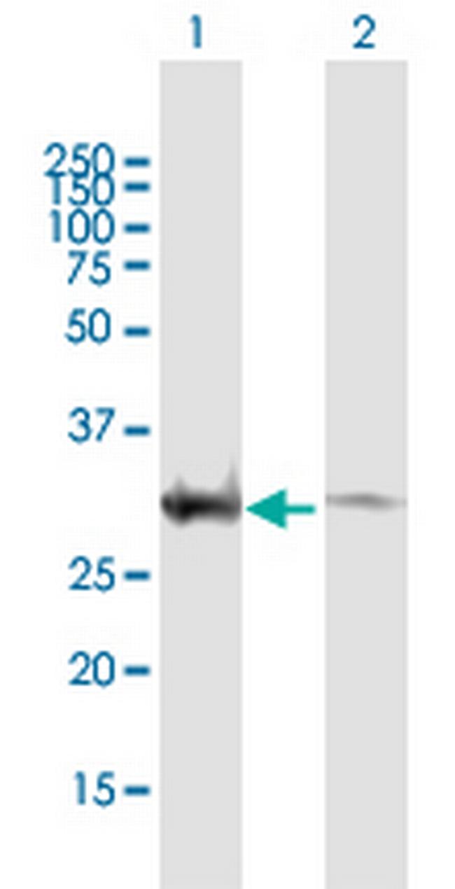 EXOSC3 Antibody in Western Blot (WB)