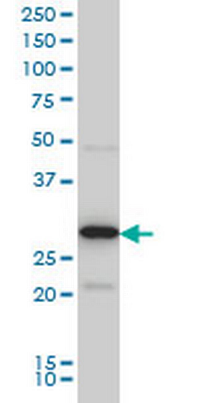 EXOSC3 Antibody in Western Blot (WB)