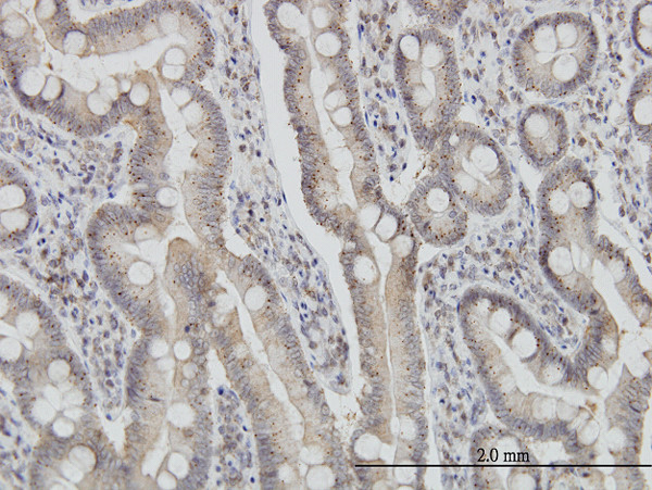 FIS1 Antibody in Immunohistochemistry (Paraffin) (IHC (P))