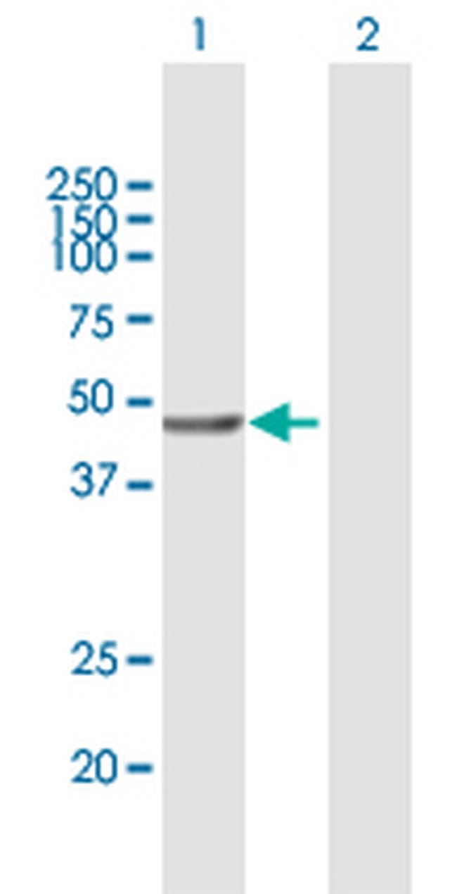 VPS36 Antibody in Western Blot (WB)