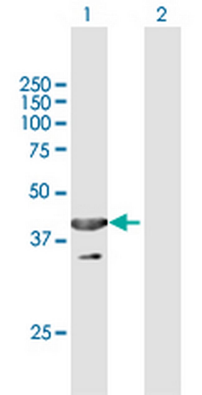 UBXN1 Antibody in Western Blot (WB)