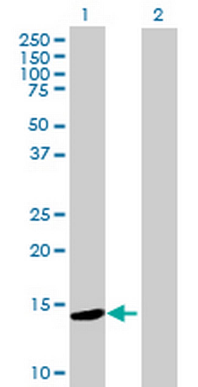 ZNF593 Antibody in Western Blot (WB)