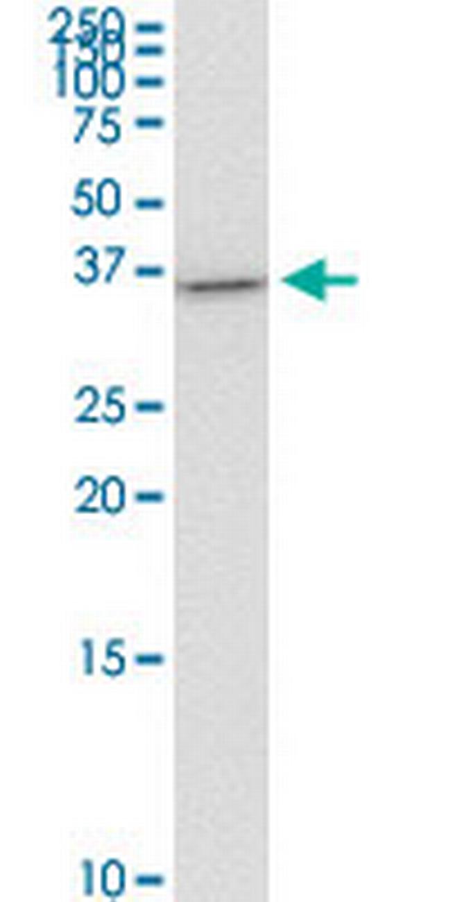 ZBTB7B Antibody in Western Blot (WB)