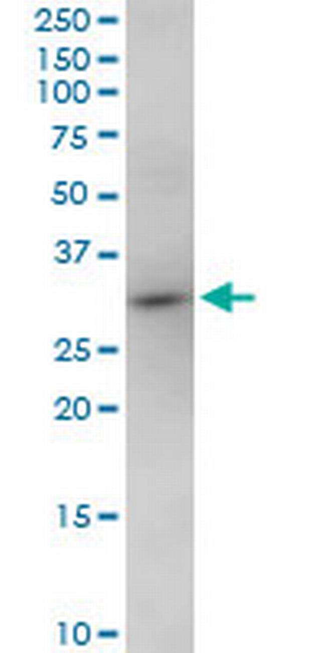 NOSIP Antibody in Western Blot (WB)