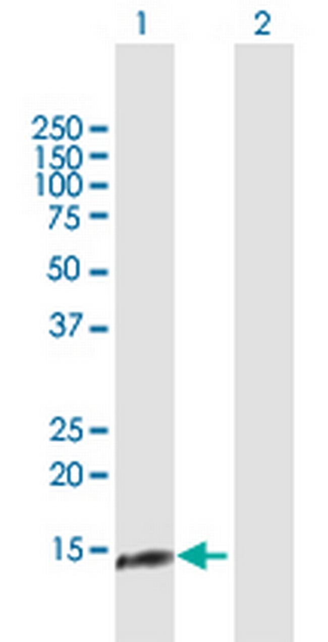 NDUFA13 Antibody in Western Blot (WB)