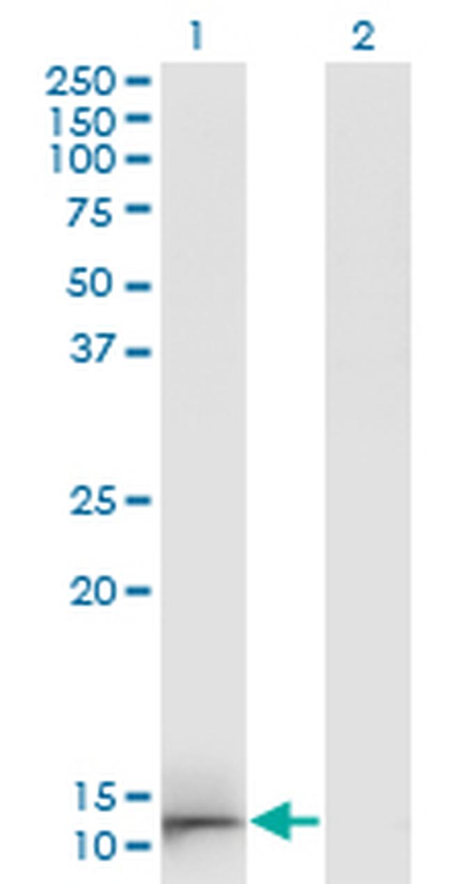 GAL Antibody in Western Blot (WB)