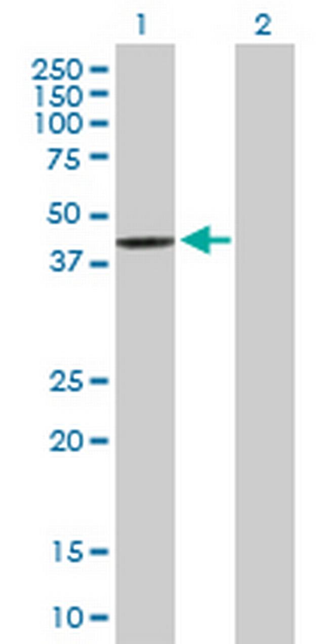 SCCPDH Antibody in Western Blot (WB)