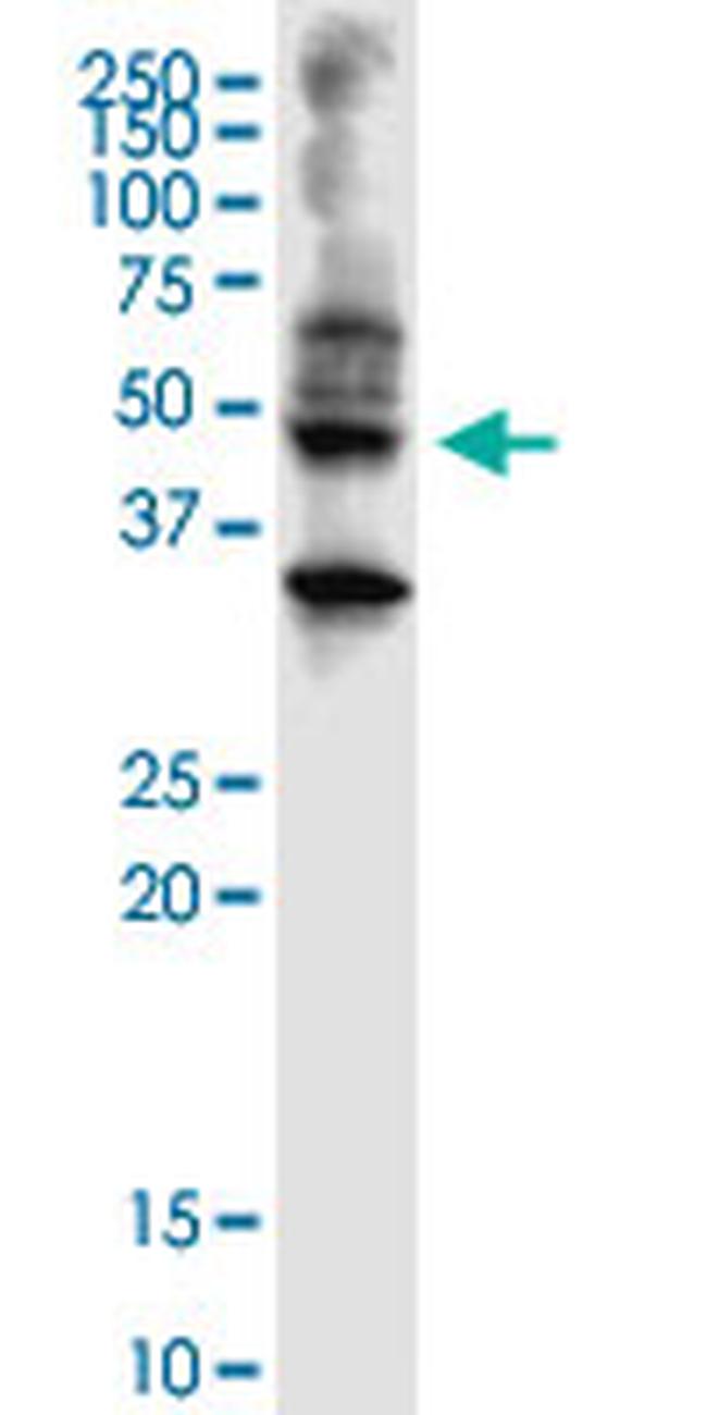 ABHD5 Antibody in Western Blot (WB)