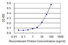 ABHD5 Antibody in ELISA (ELISA)