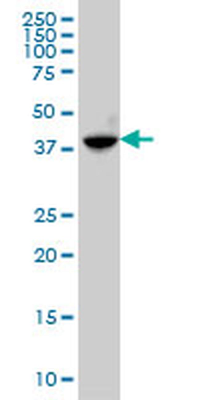 ABHD5 Antibody in Western Blot (WB)