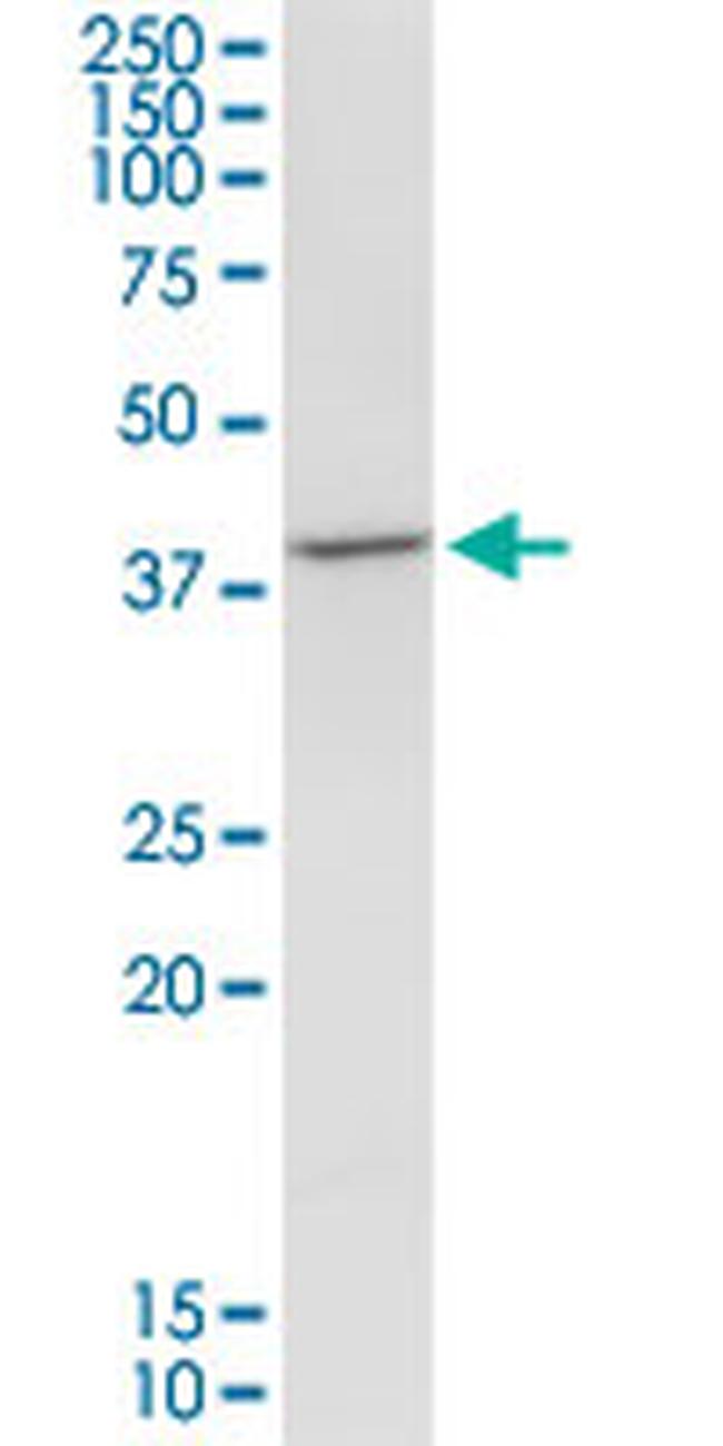 TFB1M Antibody in Western Blot (WB)