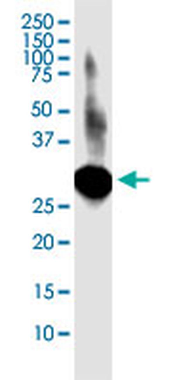 LACTB2 Antibody in Western Blot (WB)