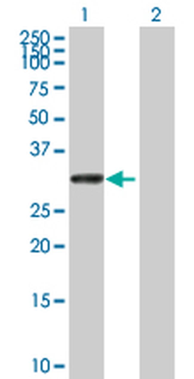 UTP11L Antibody in Western Blot (WB)