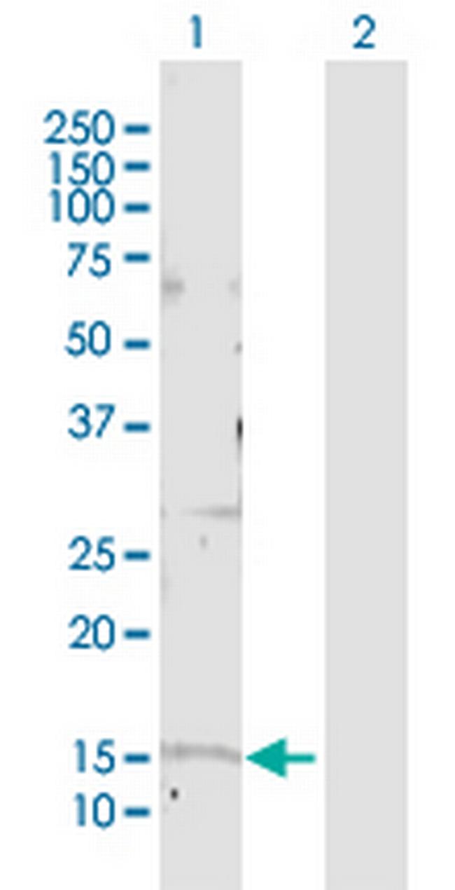 GOLGA7 Antibody in Western Blot (WB)